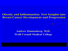 Obesity and Inflammation: New Insights into Breast Cancer Development and Progression Obesity and Inflammation: New Insights into Breast Cancer Development and Progression