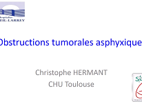 Obstructions tumorales asphyxiques