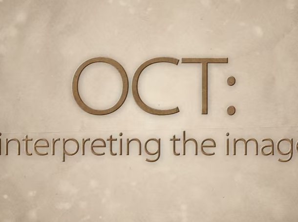 OCT: Interpreting the image