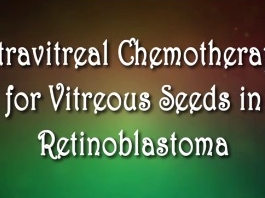 Tumeurs occulaires et Pathologies - Chimiothérapie intravitréenne pour les graines vitreuses dans le rétinoblastome