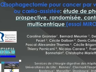 Oesophagectomie pour cancer par voie ouverte ou coelio-assistée : étude de phase III, prospective, randomisée, contrôlée, multicentrique (essai MIRO)