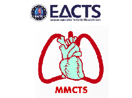 Off-pump myocardial revascularization