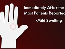 Old Hands Like New. Plastic Surgery Hot Topics with Rod J. Rohrich, MD
