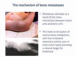 Oncological Treatment of Pain in Cancer Patients � the Role of Radiotherapy