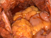 Open Field Fluorescence Imaging (SPY-PHI)