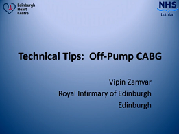 Operative tips & tricks - Off Pump set-up & grafting