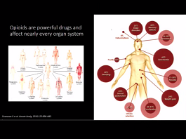 Opioid Drugs Side Effects: How to Manage in Short and Long Term Treatment