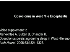 Opsoclonus in West Nile Encephalitis Opsoclonus in West Nile Encephalitis