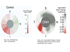 Optic Nerve Head Biomechanics