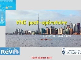 Optimiser la ventilation en perioperatoire - VNI postoperatoire
