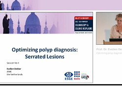 Optimiser le diagnostic de la polype : Lésions dentelées