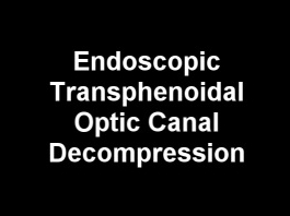 Orbite, Lacrymal, Chirurgie plastique - Décompression du canal optique endoscopique transsphénoïdale dans la neuropathie optique traumatique directe et indirecte
