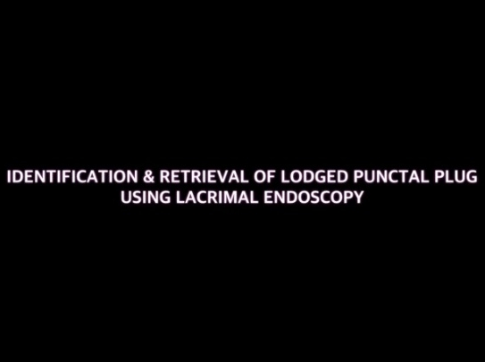 Orbit, Lacrimal, Plastic Surgery - Identification and Retrieval of Lodged Punctal Plugs Using Lacrimal Endoscopy