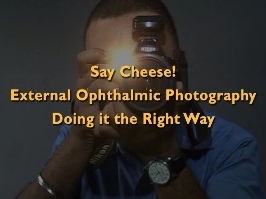 Orbite, Lacrymal, Chirurgie Plastique - Faites Cheese! Photographie ophtalmique externe : bonnes pratiques Orbite, Lacrymal, Chirurgie Plastique - Faites Cheese! Photographie ophtalmique externe : bonnes pratiques