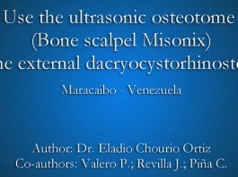 Orbite, Lacrymal, Chirurgie plastique - Utiliser l'ostéotome à ultrasons (scalpel à os Misonix) dans la dacryocystorhinostomie externe Orbite, Lacrymal, Chirurgie plastique - Utiliser l'ostéotome à ultrasons (scalpel à os Misonix) dans la dacryocystorhinostomie externe