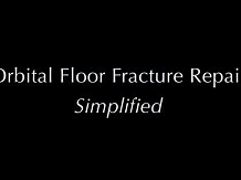 Orbital Floor Fracture Repair Simplified Orbital Floor Fracture Repair Simplified