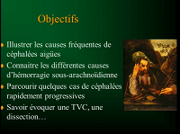 Orientation diagnostique devant une céphalée