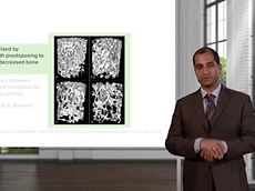Osteoporosis: Introduction & Causes  Endocrine Pathology Osteoporosis: Introduction & Causes  Endocrine Pathology