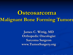 Osteosarcoma Malignant Bone Forming Tumors