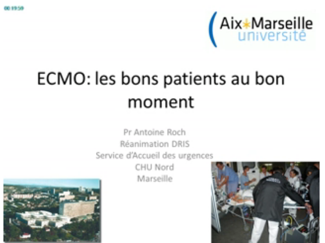 Oxygénation par membrane extra-corporelle (ECMO) dans  le syndrome de détresse respiratoire aigüe après la conférence de consensus - ECMO les bons patients au bon moment - 2015