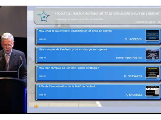 Pédiatrie (2/7) - Malformations arétrio-veineuses (MAV) chez le nourrisson : classification et prise en charge