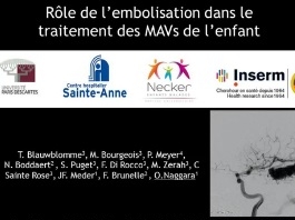Pédiatrie (5/7) - Rôle de l'embolisation de la malformation artério-veineuse (MAV) de l'enfant Pédiatrie (5/7) - Rôle de l'embolisation de la malformation artério-veineuse (MAV) de l'enfant