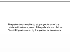 Palate and Uvula Tremor Palate and Uvula Tremor