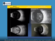 Pannel de situations échogaphiques en pratique