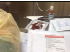 paracentesis - drainage of abdominal fluid