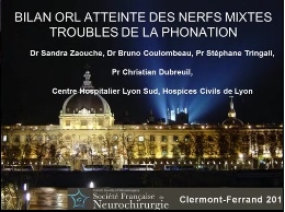Paralysies des nerfs (2/3) - Exploration ORL d'une paralysie des nerfs mixtes : troubles de la phonation
