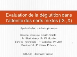 Paralysies des nerfs (3/3) - Bilan et prise en charge des troubles de déglutition Paralysies des nerfs (3/3) - Bilan et prise en charge des troubles de déglutition