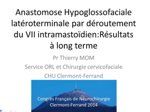 Paralysies du nerf faciale - Anastomoses hypoglosso-faciales : quand la proposer et quels résultats  ?