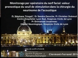 Paralysies du nerf faciale - Monitorage per opératoire : valeur pronostique du seuil de stimulation dans la chirurgie du neurinome de l'acoustique