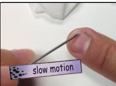 paronychia - abscess of side of the nail