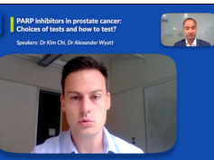 PARP inhibitors in prostate cancer: Choices of tests and how to test?