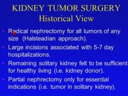 videousa/2015/2015-AUA/Panel_Discussions/Partial_Nephrectomy-Paul_Russo.mp4