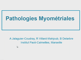 Pathologies myométriales (myome, adenomyose, MAV, sarcome)