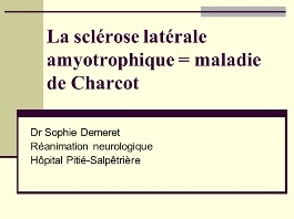 Pathologies neuro-musculaires - Sclérose latérale amyotrophique
