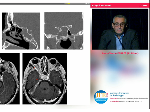Pathologies sinusiennes