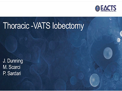 Pathologies thoraciques - Lobectomie vidéo-assistée (VATS) Pathologies thoraciques - Lobectomie vidéo-assistée (VATS)