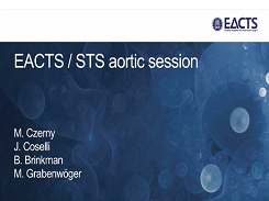 Pathologies vasculaires - Session "Aorte" de l'EACTS et du STS Pathologies vasculaires - Session "Aorte" de l'EACTS et du STS