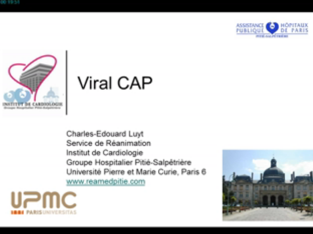 2015/2015_43eme_congres_international_de_la_SRLF/Pathologies_virales_graves/SRLF_2015_Pneumonies_virales_communautaires_quand_y_penser_x264.mp4