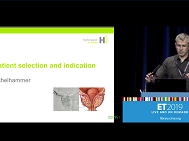 Patient selection and indication