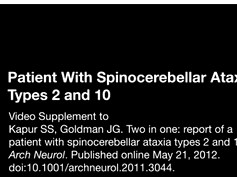 Patient With Spinocerebellar Ataxia Types 2 and 10 Patient With Spinocerebellar Ataxia Types 2 and 10