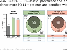 PD-L1/TILs/TMB in Immunotherapy PD-L1/TILs/TMB in Immunotherapy