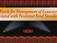 Pearls for Management of Cataract Associated With Persistent Fetal Vasculature Pearls for Management of Cataract Associated With Persistent Fetal Vasculature