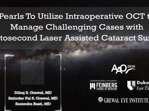 Pearls for Utilizing Intraoperative OCT to Manage Challenging Cases With Femtosecond Laser Assisted Cataract Surgery Pearls for Utilizing Intraoperative OCT to Manage Challenging Cases With Femtosecond Laser Assisted Cataract Surgery