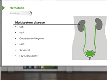 Pediatric Hematuria (Blood in Urine) - Pediatrics