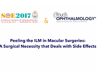 Peeling the ILM in Macular Surgeries: A Surgical Necessity that Deals with Side Effects Peeling the ILM in Macular Surgeries: A Surgical Necessity that Deals with Side Effects
