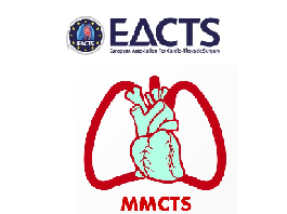 Perceval S sutureless aortic valve prosthesis implantation